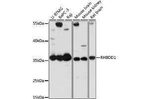 Western blot analysis of extracts of various cell lines, using RHBDD1 antibody (ABIN7269978) at 1:1000 dilution. (RHBDD1 Antikörper  (AA 206-315))