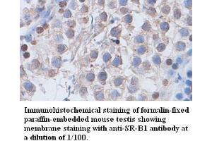 Image no. 1 for anti-Scavenger Receptor Class B, Member 1 (SCARB1) antibody (ABIN791178) (SCARB1 Antikörper)
