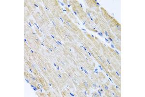 Immunohistochemistry of paraffin-embedded mouse heart using ABCB8 antibody at dilution of 1:100 (x40 lens). (ABCB8 Antikörper)