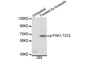 Western blot analysis of extracts of 293 cells, using Phospho-PAK1-T212 antibody (ABIN5996121). (PAK1 Antikörper  (pThr212))