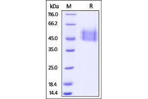 Cynomolgus IL-4 R alpha, His Tag on SDS-PAGE under reducing (R) condition. (IL4 Receptor Protein (AA 26-232) (His tag))