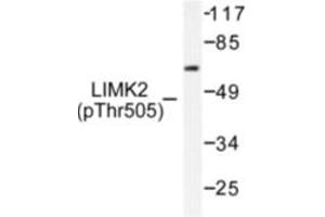 Image no. 1 for anti-LIM Domain Kinase 2 (LIMK2) (pThr505) antibody (ABIN318064) (LIMK2 Antikörper  (pThr505))