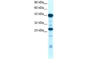 WB Suggested Anti-SIX6 Antibody Titration:  0. (SIX Homeobox 6 Antikörper  (N-Term))