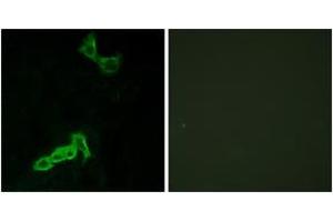 Immunofluorescence analysis of MCF7 cells, using GPR137C Antibody. (GPR137C Antikörper  (AA 256-305))