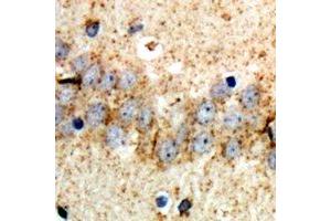 Immunohistochemical analysis of ABCB8 staining in rat brain formalin fixed paraffin embedded tissue section.