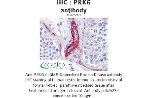 Image no. 3 for anti-PRKG antibody (ABIN1738352) (PRKG Antikörper)