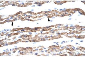 Human Muscle; HumanMuscle; PQBP1 antibody - middle region in Human Muscle cells using Immunohistochemistry (PQBP1 Antikörper  (Middle Region))