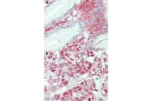 Immunohistochemical staining of human stomach (A) and human adrenal gland (B) with SLC7A2 polyclonal antibody . (SLC7A2 Antikörper  (Internal Region))