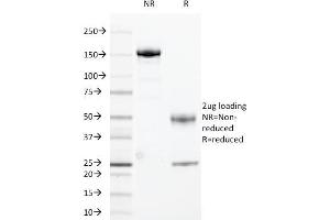SDS-PAGE Analysis Purified HLA-DRA Mouse Monoclonal Antibody (169-1B5. (HLA-DRA Antikörper)