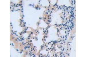 IHC-P analysis of Mouse Tissue, with DAB staining. (CAPN10 Antikörper  (AA 22-374))