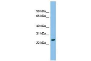 Image no. 1 for anti-Adenylate Kinase 2 (AK2) (AA 143-192) antibody (ABIN6744817)