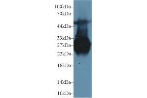 Western Blot; Sample: Rat Liver lysate; Primary Ab: 1µg/ml Rabbit Anti-Rat MBL Antibody Second Ab: 0. (MBL2 Antikörper  (AA 19-244))