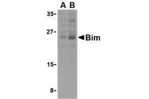 Western blot analysis of Bim in K562 cell lysates with AP30151PU-N Bim antibody (IN2) at (A) 2. (BIM Antikörper  (Intermediate Domain 2))