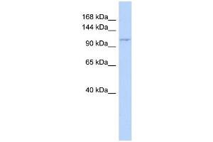WB Suggested Anti-ZC3H7B Antibody Titration: 0. (ZC3H7B Antikörper  (Middle Region))