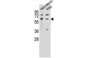 Western blot analysis of HTR3A Antibody (N-term) in MDA-MB453, K562 cell line lysates (35ug/lane). (Serotonin Receptor 3A Antikörper  (N-Term))