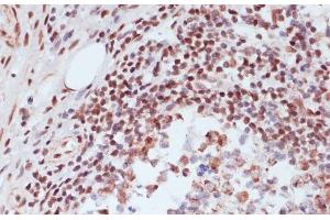 Immunohistochemistry of paraffin-embedded Human appendix using Phospho-CREB1(S133) Polyclonal Antibody at dilution of 1:100 (40x lens). (CREB1 Antikörper  (pSer133))