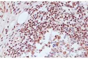 Immunohistochemistry of paraffin-embedded Human appendix using Phospho-CREB1(S133) Polyclonal Antibody at dilution of 1:100 (40x lens).