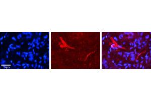 Rabbit Anti-OGT Antibody     Formalin Fixed Paraffin Embedded Tissue: Human Pineal Tissue  Observed Staining: Cytoplasmic in processes of pinealocytes and endothelial cells in blood vessels  Primary Antibody Concentration: 1:100  Other Working Concentrations: 1/600  Secondary Antibody: Donkey anti-Rabbit-Cy3  Secondary Antibody Concentration: 1:200  Magnification: 20X  Exposure Time: 0. (OGT Antikörper  (N-Term))