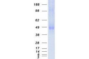 Western Blotting (WB) image for Kringle Containing Transmembrane Protein 2 (KREMEN2) (Transcript Variant 2) protein (Myc-DYKDDDDK Tag) (ABIN2724424)