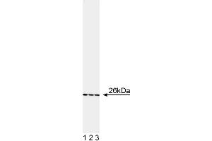 Western blot analysis of bcl-2. (Bcl-2 Antikörper  (AA 61-76))
