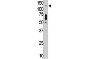 The TLR7 polyclonal antibody  is used in Western blot to detect TLR7 in mouse liver tissue lysate.