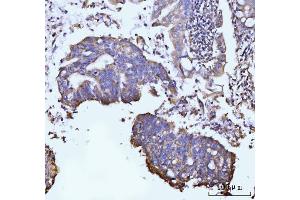 IHC analysis of GLUL using anti-GLUL antibody (ABIN7602403). (GLUL Antikörper  (AA 74-373))