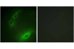 Immunofluorescence analysis of HuvEc cells, using FOXO1A (Ab-329) Antibody. (FOXO1 Antikörper  (AA 295-344))