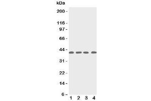 Western blot testing of p53R2 antbody; Lane 1: rat thymus;  2: human MCF-7;  3: (h) A431;  4: (h) HeLa cell lysate. (RRM2B Antikörper  (C-Term))