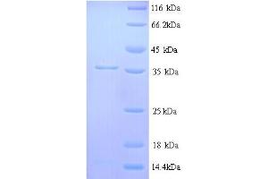 SDS-PAGE (SDS) image for Muscarinic Acetylcholine Receptor M1 (CHRM1) (AA 210-366), (Cytoplasmic Domain), (Cytosolic) protein (His tag) (ABIN5713358)