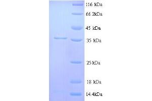 SDS-PAGE (SDS) image for Muscarinic Acetylcholine Receptor M1 (CHRM1) (AA 210-366), (Cytoplasmic Domain), (Cytosolic) protein (His tag) (ABIN5713358) (CHRM1 Protein (AA 210-366, Cytoplasmic Domain, Cytosolic) (His tag))