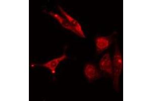 ABIN6277006 staining  COLO205 cells by IF/ICC. (PSMD2 Antikörper  (C-Term))