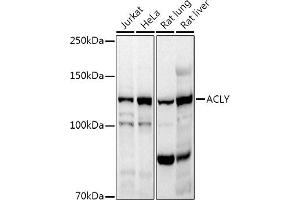 Western blot analysis of extracts of various cell lines, using ACLY antibody (ABIN7265716) at 1:1000 dilution. (ACLY Antikörper  (AA 752-1101))