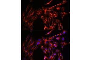Immunofluorescence analysis of U-2 OS cells using α-Tubulin Rabbit pAb (ABIN3020549, ABIN3020550 and ABIN3020551) at dilution of 1:100 (40x lens). (TUBA4A Antikörper  (AA 1-180))