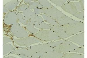 ABIN6278144 at 1/100 staining Mouse muscle tissue by IHC-P. (ING3 Antikörper  (Internal Region))