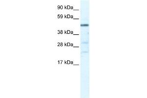 Western Blot showing HSFY1 antibody used at a concentration of 1-2 ug/ml to detect its target protein. (HSFY1 Antikörper  (N-Term))