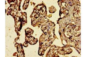 Immunohistochemistry of paraffin-embedded human placenta tissue using ABIN7174832 at dilution of 1:100 (C3ORF14 Antikörper  (AA 9-128))