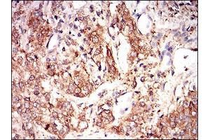 Immunohistochemistry (IHC) image for anti-Eukaryotic Translation Initiation Factor 2A, 65kDa (EIF2A) (AA 448-576) antibody (ABIN1724933)