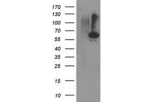Western Blotting (WB) image for anti-Protein Phosphatase, Mg2+/Mn2+ Dependent, 1B (PPM1B) antibody (ABIN1500373) (PPM1B Antikörper)