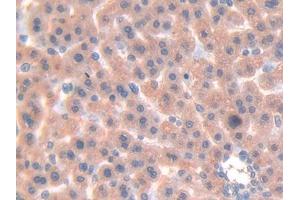 Used in DAB staining on fromalin fixed paraffin- embedded liver tissue (LGALS7 Antikörper  (AA 1-128))