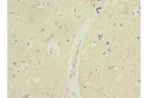 Immunohistochemistry of paraffin-embedded human brain tissue using ABIN7172732 at dilution of 1:100 (MTERFD1 Antikörper  (AA 69-300))
