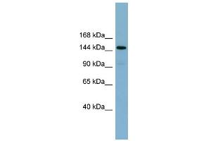 WB Suggested Anti-KIAA1199 Antibody Titration:  0.