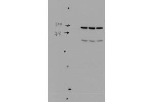 Western blot analysis of Mouse kidney tissue lysates showing detection of ENaC protein using Rabbit Anti-ENaC Polyclonal Antibody . (SCNN1A Antikörper  (AA 46-68) (Atto 488))