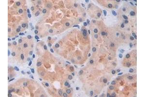 Immunohistochemistry (IHC) image for anti-Arrestin, beta 1 (ARRB1) (AA 3-246) antibody (ABIN7441790)