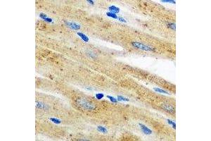 Immunohistochemical analysis of AKR7A2 staining in mouse heart formalin fixed paraffin embedded tissue section. (AKR7A2 Antikörper)