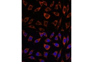 Immunofluorescence analysis of L929 cells using CTNN antibody (ABIN7266136) at dilution of 1:100.