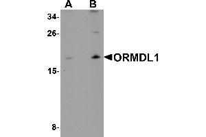 Western blot analysis of ORMDL1 in SK-N-SH Cell lysate with ORMDL1 antibody at (A) 1 µg/mL and (B) 2 µg/mL. (ORMDL1 Antikörper)