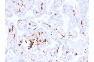 Formalin-fixed, paraffin-embedded human placenta stained with Factor 13A Recombinant Rabbit Monoclonal Antibody (F13A1/3772R). (Rekombinanter F13A1 Antikörper  (AA 46-181))