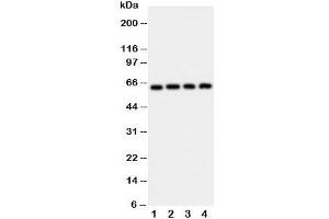 Western blot testing of p62 antibody and Lane 1:  rat brain;  2: HeLa;  3: U87;  4: A549 cell lysate (KHDRBS1 Antikörper  (N-Term))