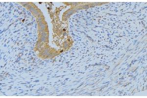 ABIN6268688 at 1/100 staining Human uterus tissue by IHC-P. (IL-4 Antikörper  (Internal Region))