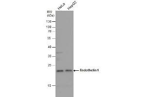 WB Image Endothelin 1 antibody detects Endothelin 1 protein by western blot analysis. (Endothelin 1 Antikörper  (C-Term))